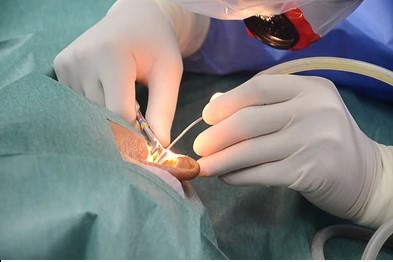 Ear Microsurgery